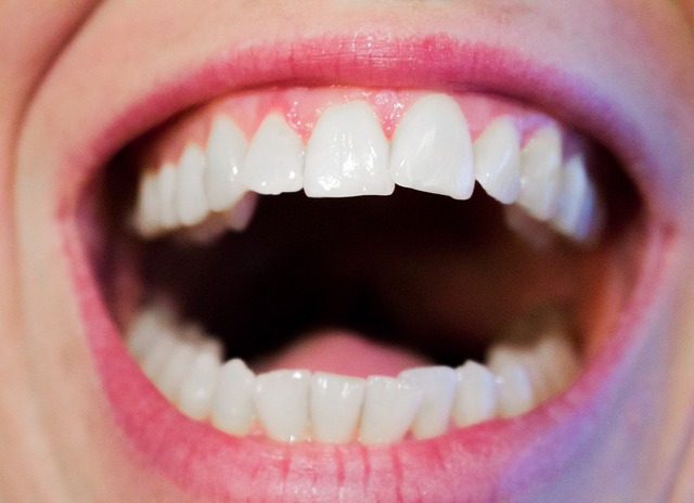 Verrast zijn Charmant naar voren gebracht Hoe krijg je witte tanden? | blog | Plein
