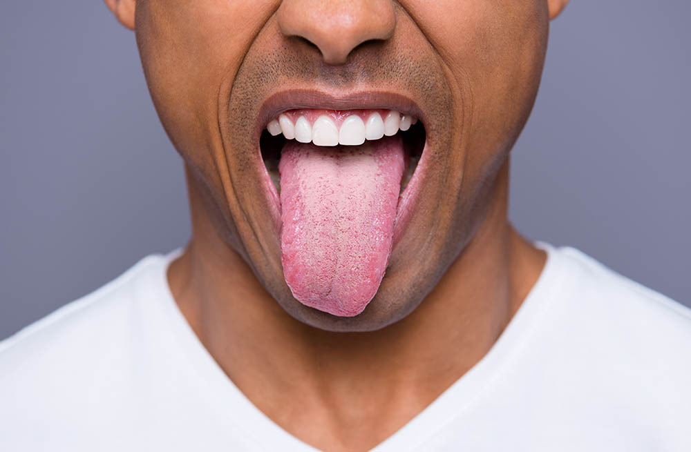 witte tong en schimmel tong