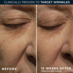 RoC Retinol Correxion Wrinkle Correct Night Cream - 29.95 euro