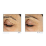 RoC Retinol Correxion Line Smoothing Oogcrème - 22.65 euro