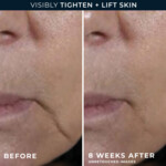 RoC Multi Correxion Firm Lift Anti-Sagging Firming Cream - 26.59 euro