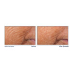 RoC Retinol Correxion Serum Nacht - 14.75 euro