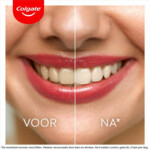Colgate Tandpasta Max White Ultra Freshness Pearls - 7.19 euro