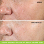 BareMinerals
 Ageless 10% Phyto-Retinol Night Concentrate - 55.99 euro