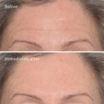Murad Skincare
 Resurgence Targeted Wrinkle Corrector - 61.49 euro