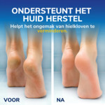 Scholl Hielkloven Voetcrème Met 25% Ureum - 8.75 euro