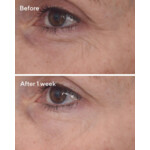Murad Skincare Retinal Resculpt Eye Lift Treatment - 86.49 euro