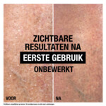 Neutrogena Intense Repair Cica Body Balm - 9.15 euro