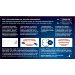 Lucovitaal Whitening Tandenstrips - 9.99 euro
