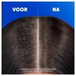 Head & Shoulders Shampoo Classic - 14.24 euro