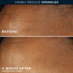 RoC Retinol Correxion Wrinkle Correct Daily Moisturiser - 34.15 euro