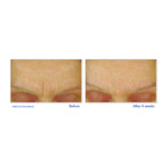 3x RoC Retinol Correxion Gezichtscrème Smoothing Max Hydration - 128.34 euro