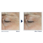 3x RoC Derm Correxion Dual Eye Cream - 77.57 euro