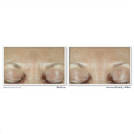 RoC Derm Correxion Fill+ Treat Serum - 29.49 euro