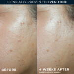 RoC Multi Correxion Even Tone Lift Daily Moist. Spf30 - 23.49 euro