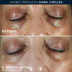 RoC Multi Correxion Even Tone + Lift Eye Cream - 18.25 euro