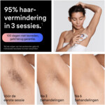 Braun Smart IPL Skin i·expert PL7431 - 548.99 euro