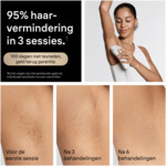 Braun IPL Silk-expert Pro 5 PL5234 - 539.99 euro