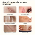 Dermatix Siliconen Gel - 25.95 euro