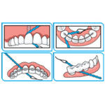 iDontix X-Floss Lite - 12.95 euro