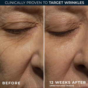 RoC Retinol Correxion Wrinkle Correct Night Cream - 29.95 euro