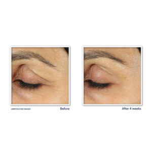RoC Retinol Correxion Line Smoothing Oogcrème - 19.99 euro
