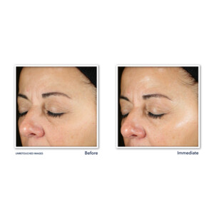RoC Multi Correxion Revive + Glow Daily Serum - 23.15 euro