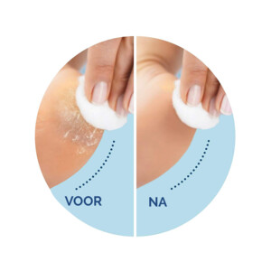 Scholl Velvet Smooth Voetvijl en Expert Care Voetenmasker Pakket - 46.98 euro
