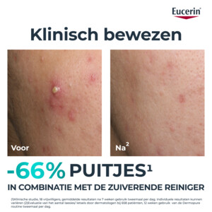 Eucerin DermoPure Triple Action Serum - 25.99 euro