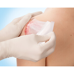 3x Leukoplast Cuticell® Contact Siliconen Wondcontactlaag 5 cm x 7,5 cm - 44.97 euro