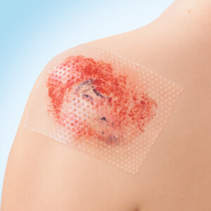 3x Leukoplast Cuticell® Contact Siliconen Wondcontactlaag 5 cm x 7,5 cm - 44.97 euro