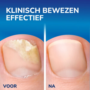 Dr. Scholl's Kalknagel 2-in-1 Behandel & Beschermset - 14.99 euro
