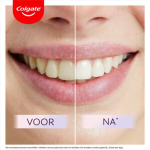 Colgate Tandpasta Max White Ultimate - 19.99 euro