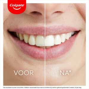 2x Colgate Max White Ultimate Led Whitening Kit - 127.87 euro