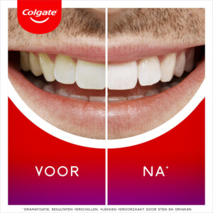 Colgate Max White Overnight Tanden Whitening Serum - 24.99 euro