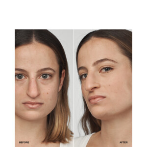Clinique Even Better Clinical Serum Foundation SPF20 CN40 Cream Chamois - 32.89 euro