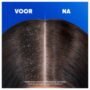 Head & Shoulders 2in1 Apple Fresh - 7.69 euro
