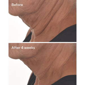 Murad Skincare Retinal Resculpt Overnight Treatment - 90.49 euro
