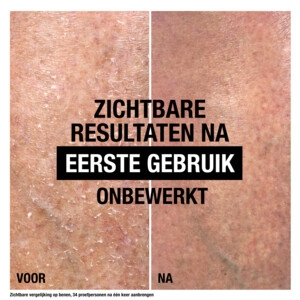 Neutrogena Intense Repair Cica Body Balm - 9.15 euro