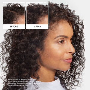 Nioxin Anti-Hairloss  Shampoo - 44.95 euro