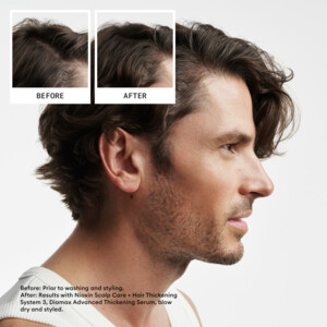 Nioxin System 2  Loyalty Kit - 35.95 euro