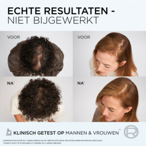 3x L'Oréal Elvive Fiber Booster Anti-Haaruitval Conditioner - 31.48 euro