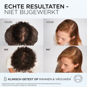 3x L'Oréal Elvive Fiber Booster Anti-Haaruitval Shampoo - 31.48 euro