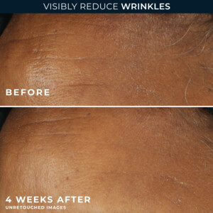 RoC Retinol Correxion Wrinkle Correct Daily Moisturiser - 34.15 euro