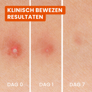 Bioré 3-in-1 Anti Spot Patches - 11.55 euro