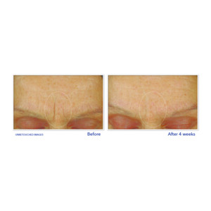 RoC Retinol Correxion Gezichtscrème Smoothing Max Hydration - 44.49 euro