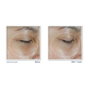 RoC Multi Correxion Revive + Glow Eye Stick - 23.39 euro