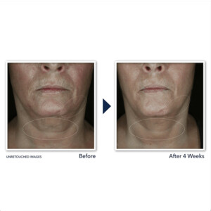 RoC Derm Correxion Contour Cream - 29.35 euro