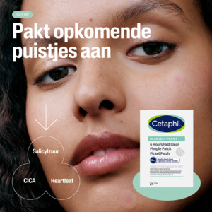 Cetaphil Puistjespleisters 6 uur - 9.69 euro