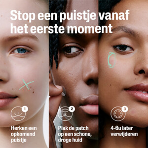 Cetaphil Puistjespleisters 6 uur - 9.69 euro